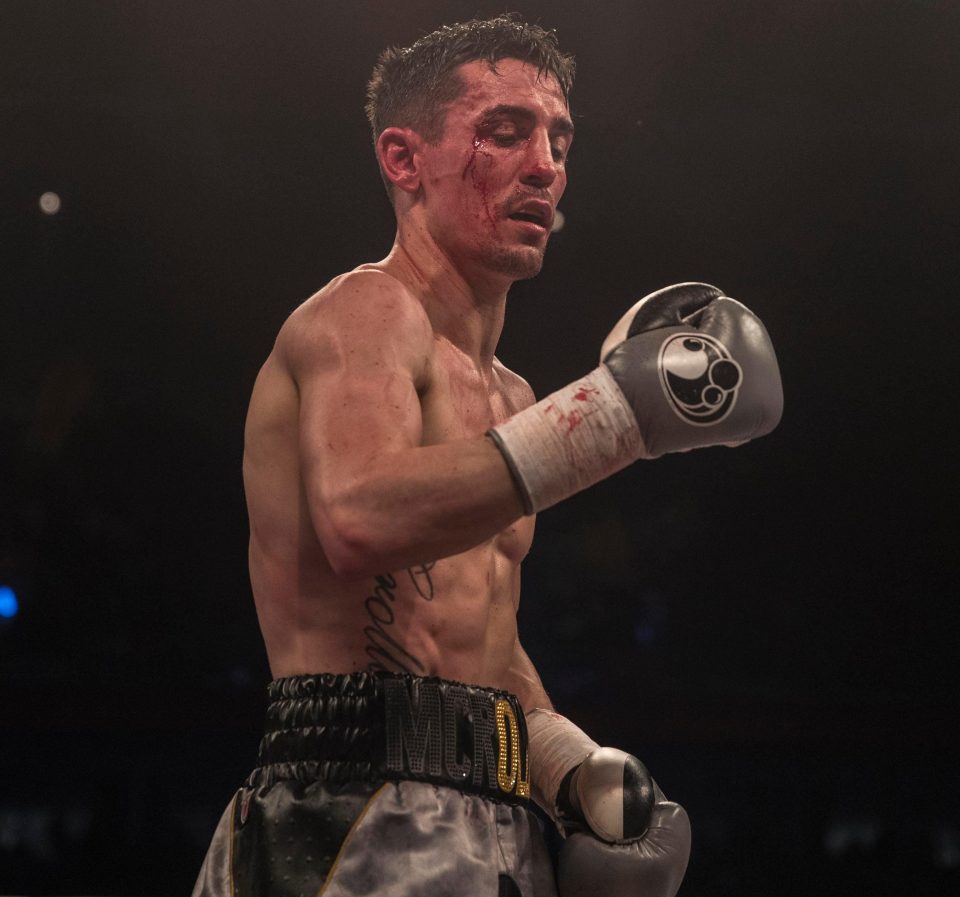  Anthony Crolla suffered a cut to his right eye against Edson Ramirez