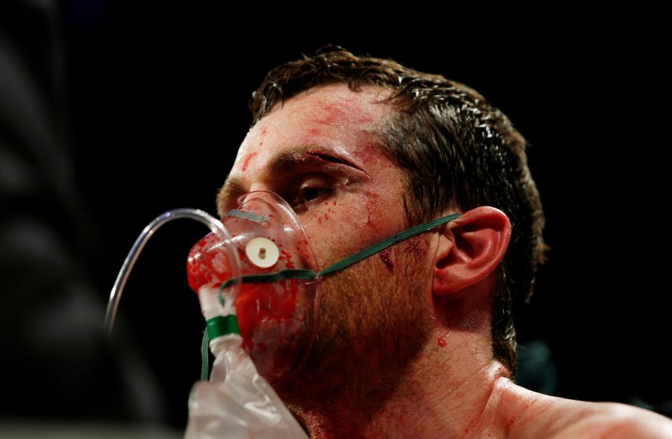  Price required oxygen following the bout after suffering a fifth defeat of his career