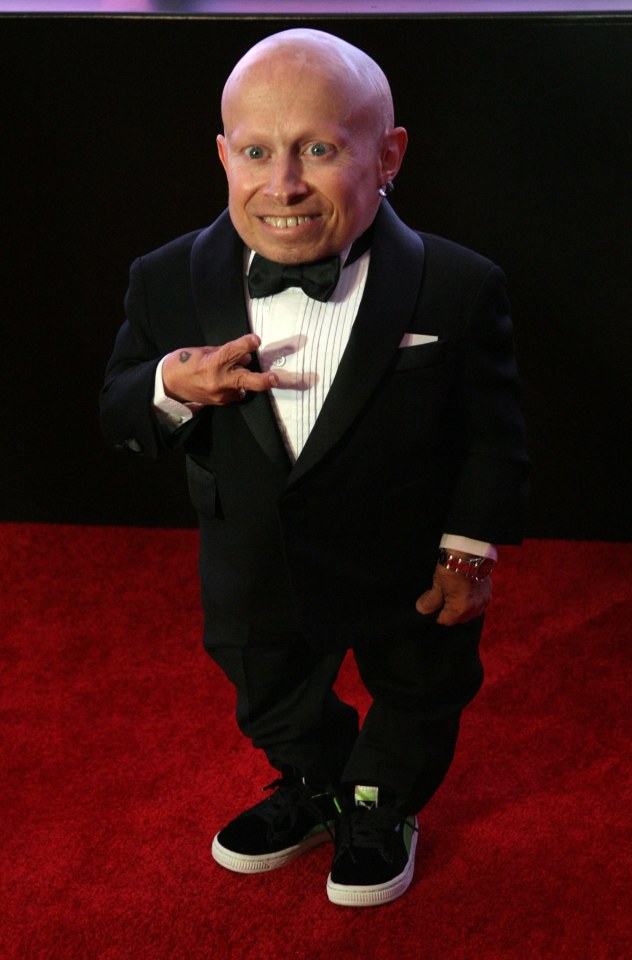  Verne Troyer was an extremely positive person and brought light to every set he worked on