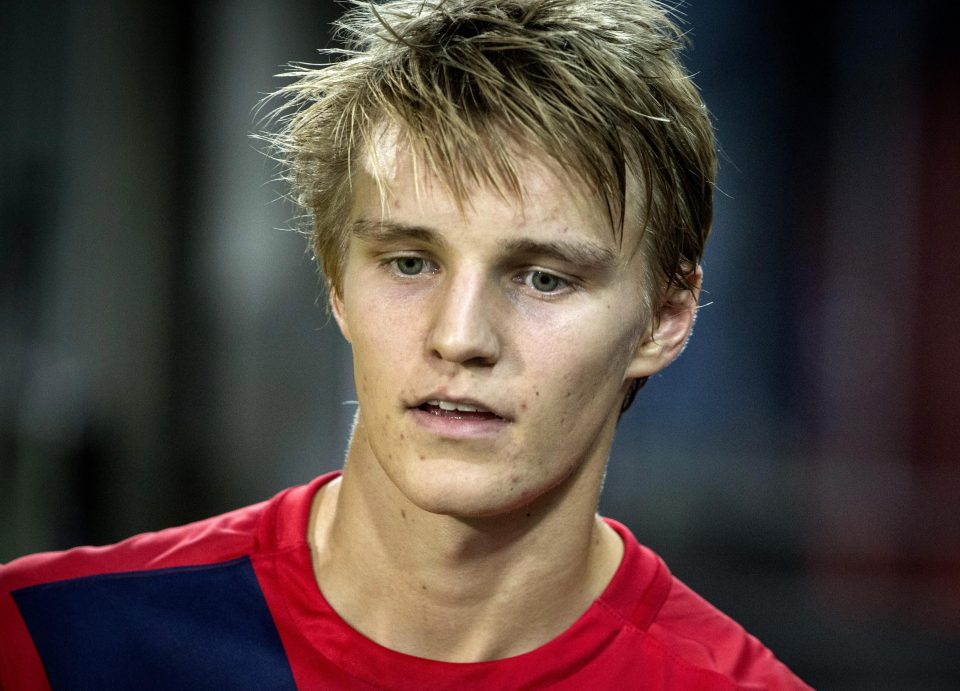  Real Madrid flop Martin Odegaard has suffered a broken metatarsal