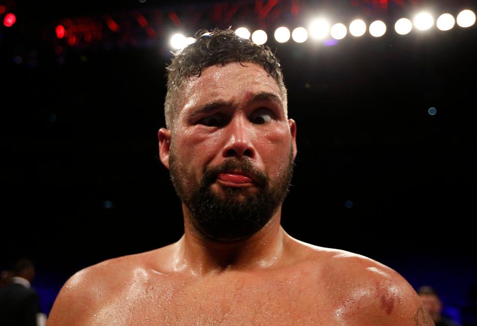  Tony Bellew might fancy a scrap with the Gypsy King