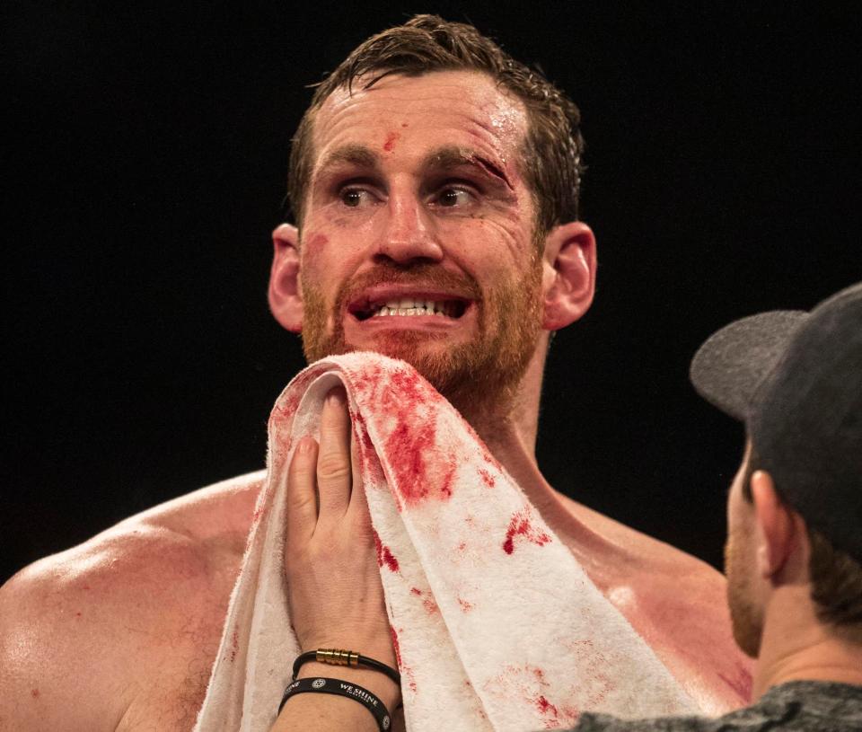  David Price was left battered, bloodied and bruised by