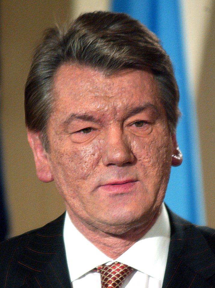  Viktor Yushchenko said the effects of the poisoning included his head swelling and pus formed all over his body