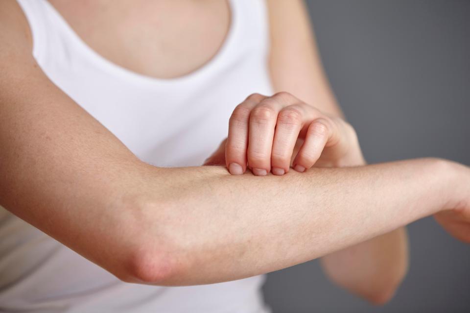  Many allergic reactions can cause itchy skin