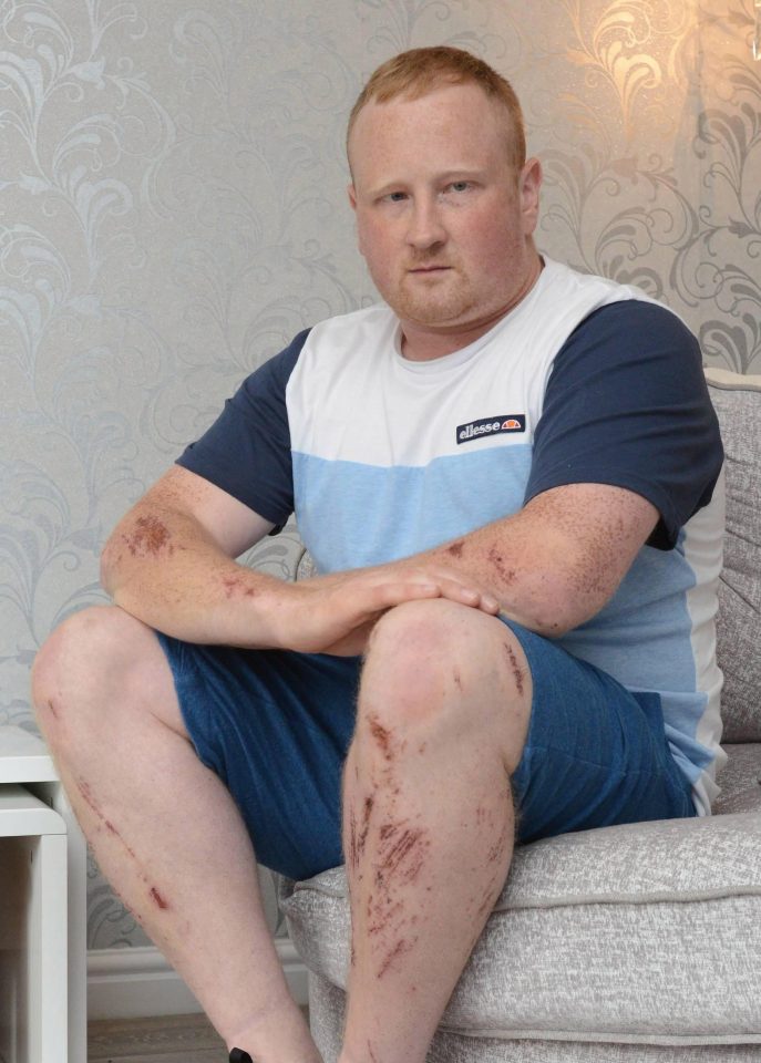  The dad-of-two was left battered and bruised after refusing to pay for sex