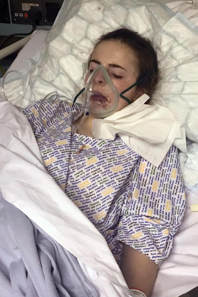  Georgia had to spend five days in hospital recovering from the horrific ordeal