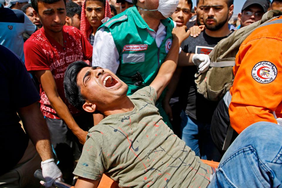  A young man cries out in pain as he is carried away by medics for treatment