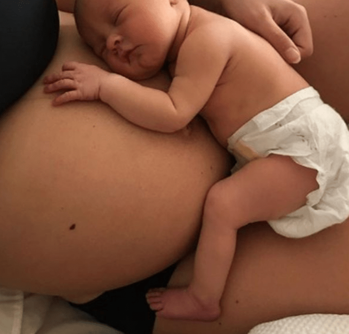  Casey revealed her post-baby tummy to fans on Instagram