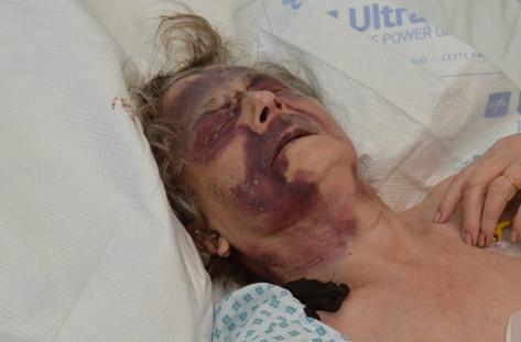  Last week great-gran Iris Warner, 90, was savagely beaten by a burglar in North West London. Her family later released images of her horrific injuries