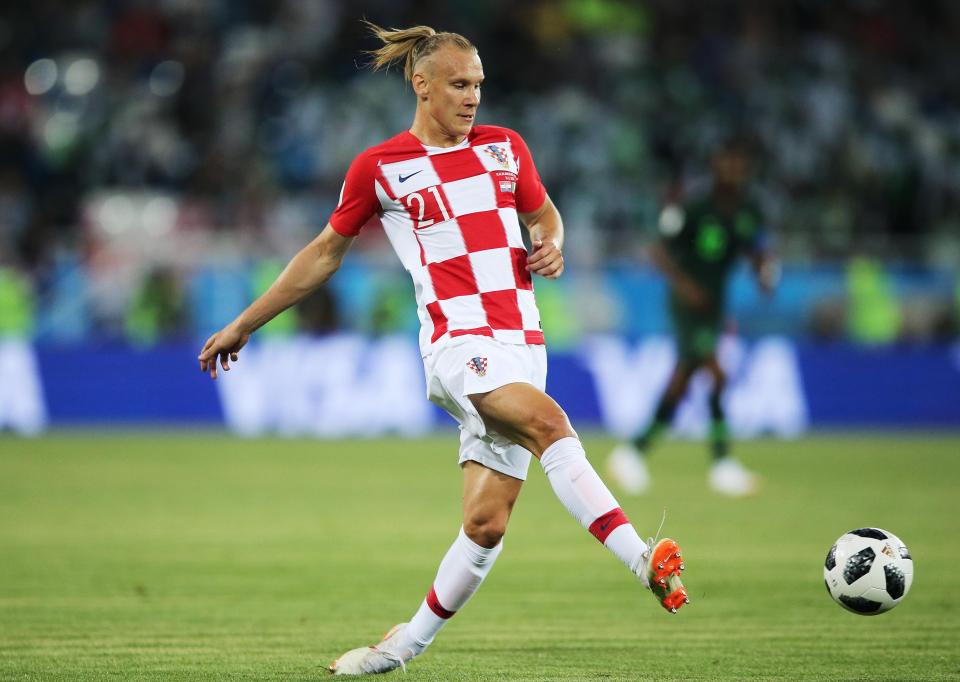  This terrible haircut got Domagoj Vida a good bit of backlash on social media.