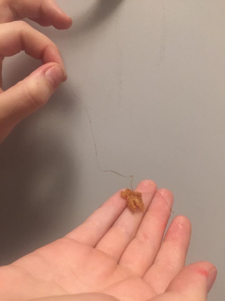  Another man from Queensland, Australia, posted an image of a hair attached to a piece of KFC batter on Facebook - he wondered if teenage staff were wearing hair nets