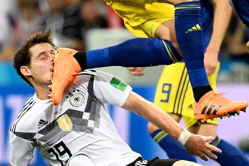  Sebastian Rudy was forced off in the first half after taking a boot to the face