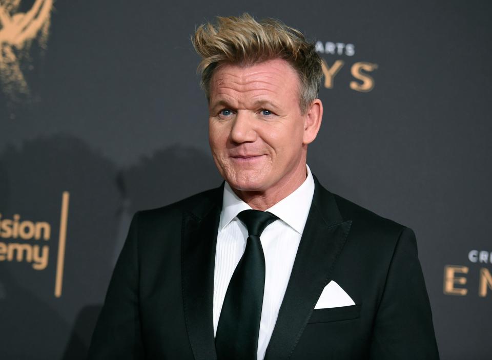  David Beckham's good friend Gordan Ramsay has also had a hair transplant