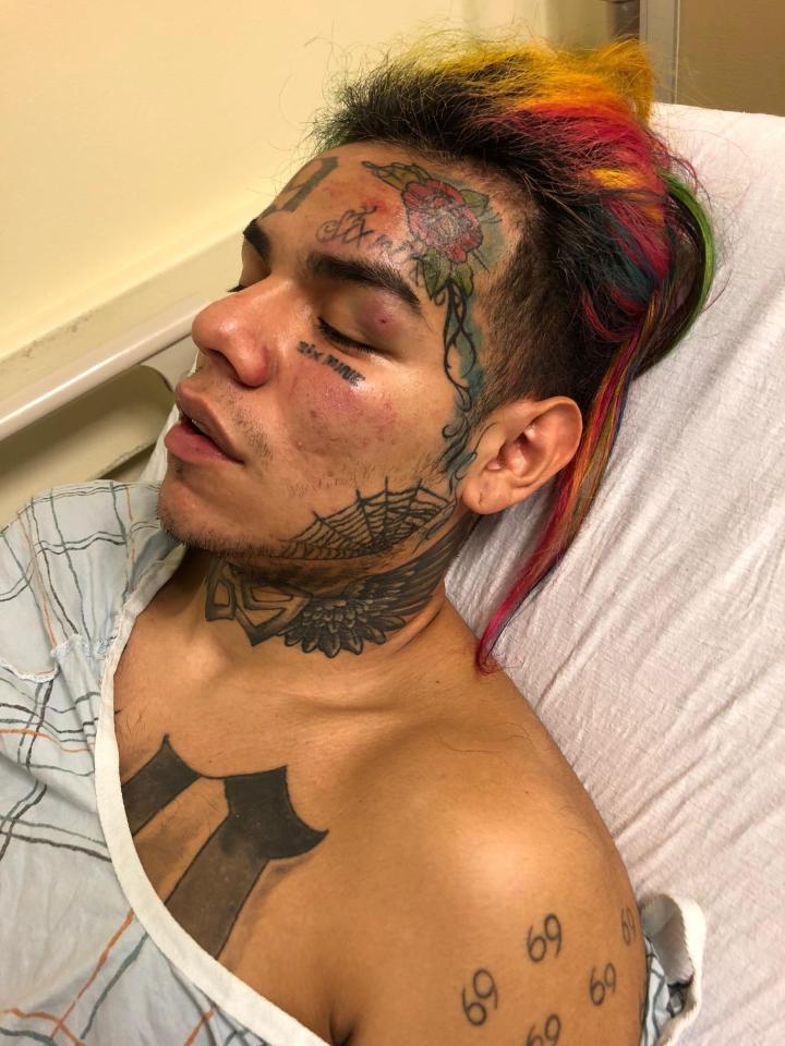  The rainbow-haired rapper was hospitalised after he was pistol-whipped, kidnapped and robbed of nearly £600,000 in June 2018