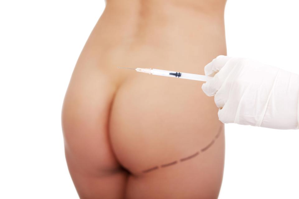 Cosmetic surgeons have called for a ban on Brazilian bum lift procedures in the UK