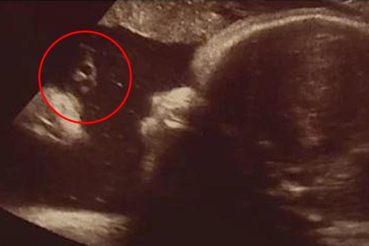  A Pennsylvania couple saw an image of Jesus in an ultrasound of their unborn baby last year