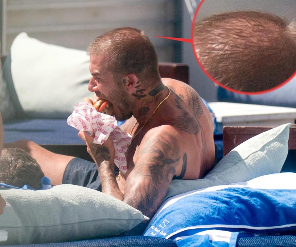  Father of four David, 43, appeared to have drastically thinner locks as he lounged by a swimming pool in Miami