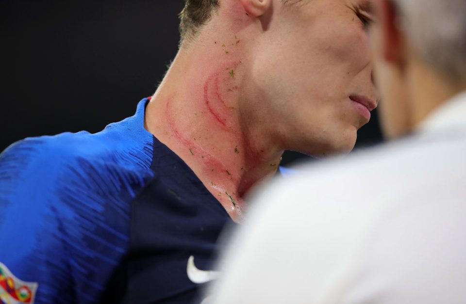  Stud marks were clearly visible after Pavard and Rudiger clashed