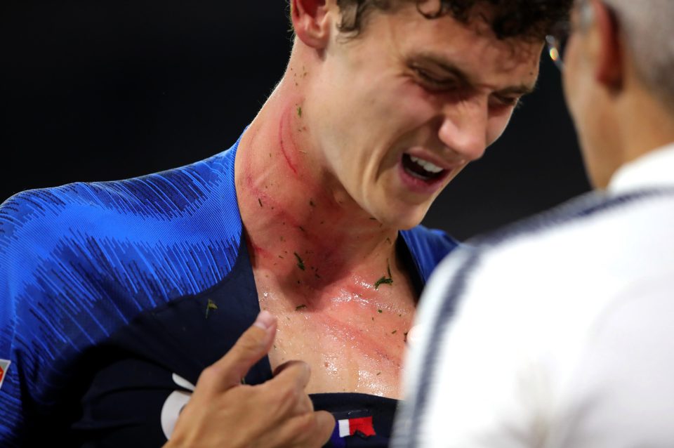  Benjamin Pavard shows the pain on his face after being caught by the studs of Antonio Rudiger