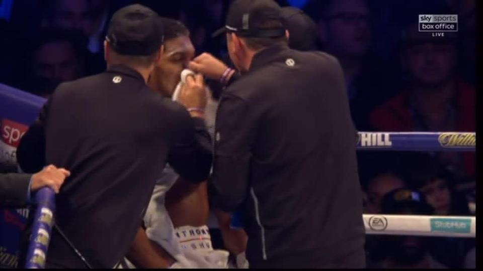  Anthony Joshua's team tended to his wounds after the opener