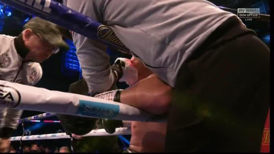  Povetkin's team attempt to stop the blood streaming out from his eye