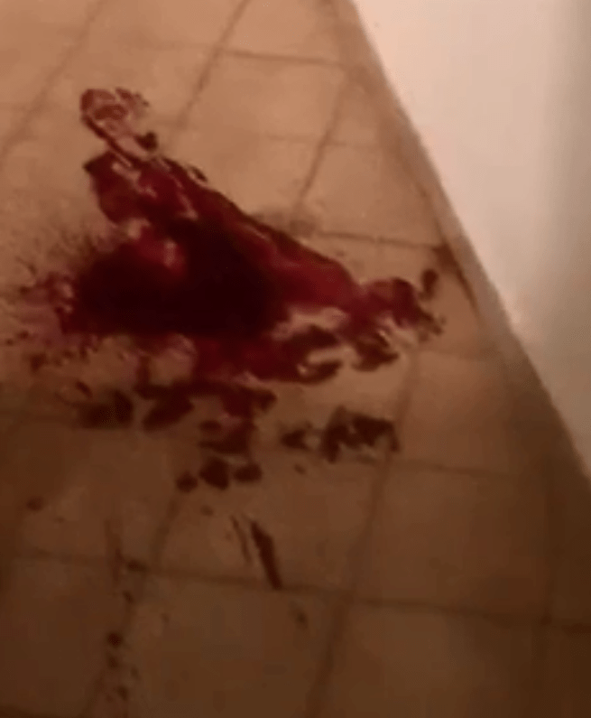  Horrified eyewitnesses followed a trail of blood through the hotel