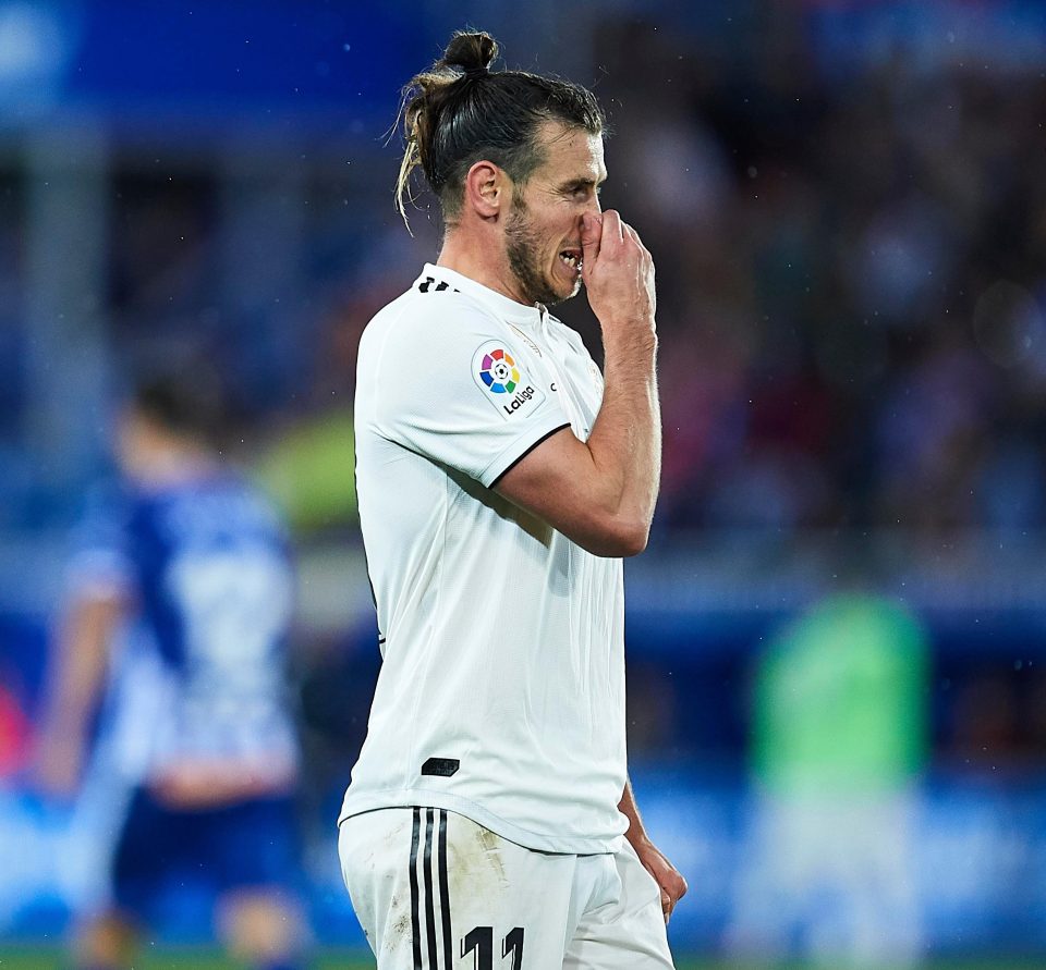  The Real Madrid star limped off in the 1-0 defeat to Alaves at the weekend