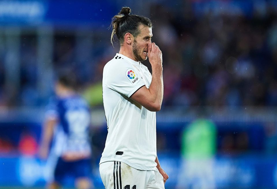  Bale had to be taken off after 79 minutes of Real Madrid's defeat to Alaves