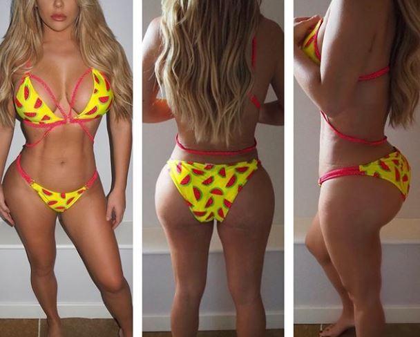  Bianca Gascoigne uploaded the results of her Brazilian bum lift operation