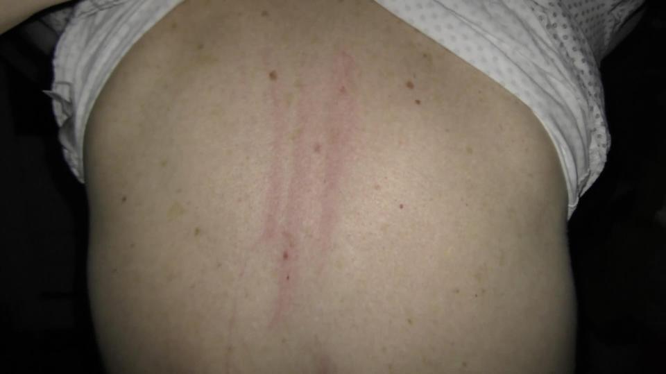  The dad was left with three distinctive claw marks down his back after he says he was attacked by a ghost