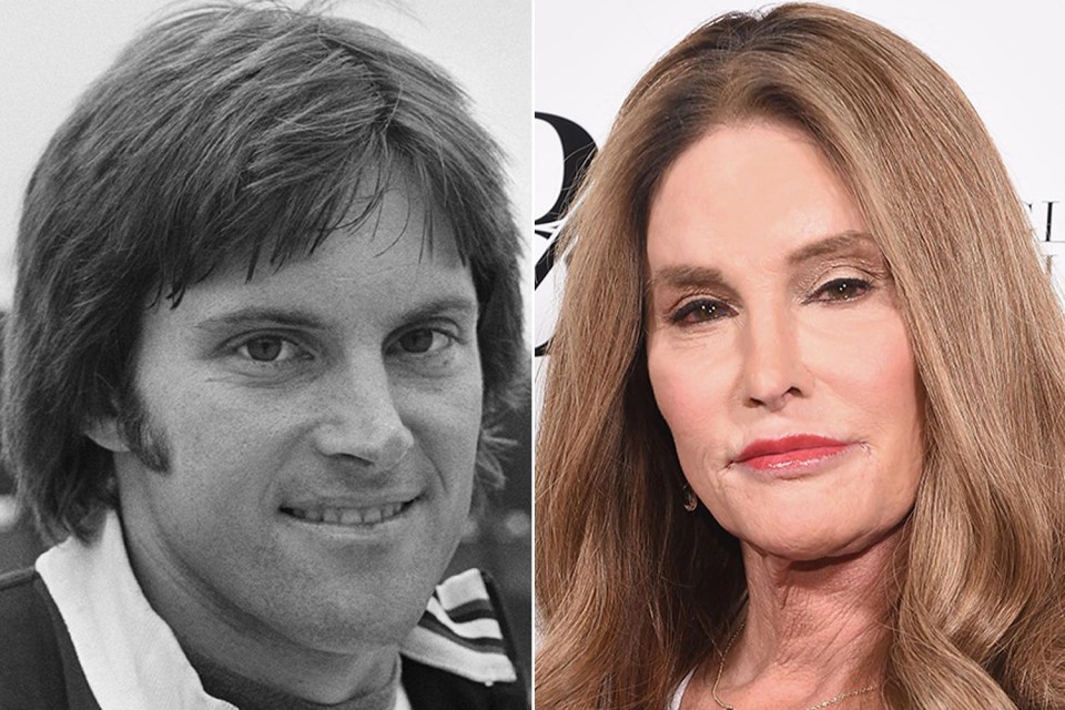 Jenner’s transformation might be the most famous of any celebrity