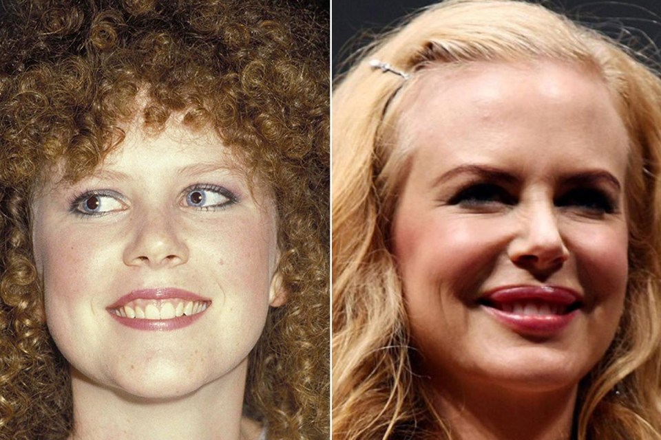 Kidman’s early shots don’t resemble much of her current appearance