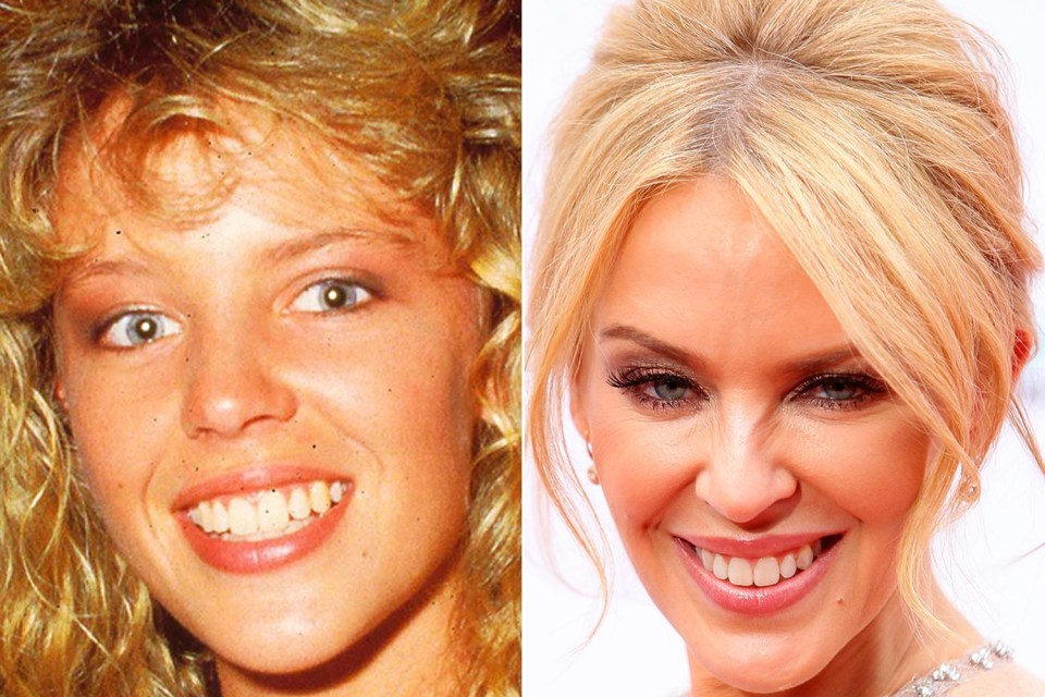 Kylie Minogue still shows plenty of her younger self