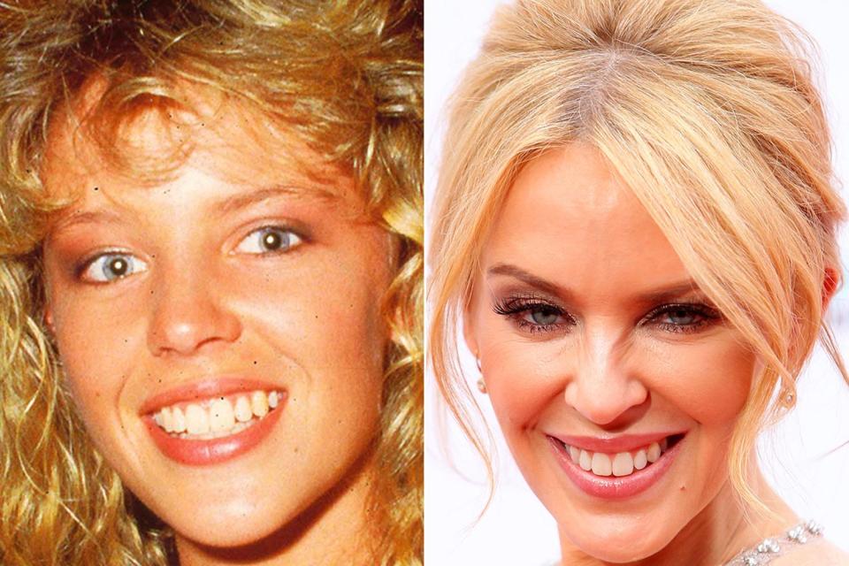  Kylie Minogue still shows plenty of her younger self