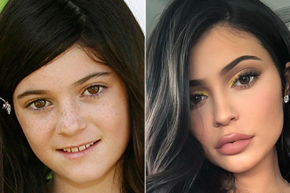 Kylie Jenner is another member of her family to totally change her appearance