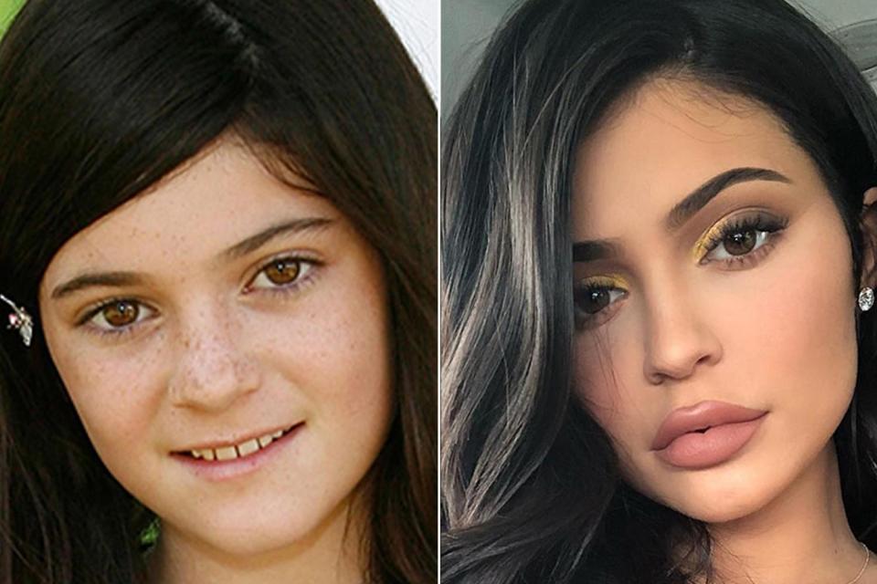  Kylie Jenner is another member of her family to totally change her appearance