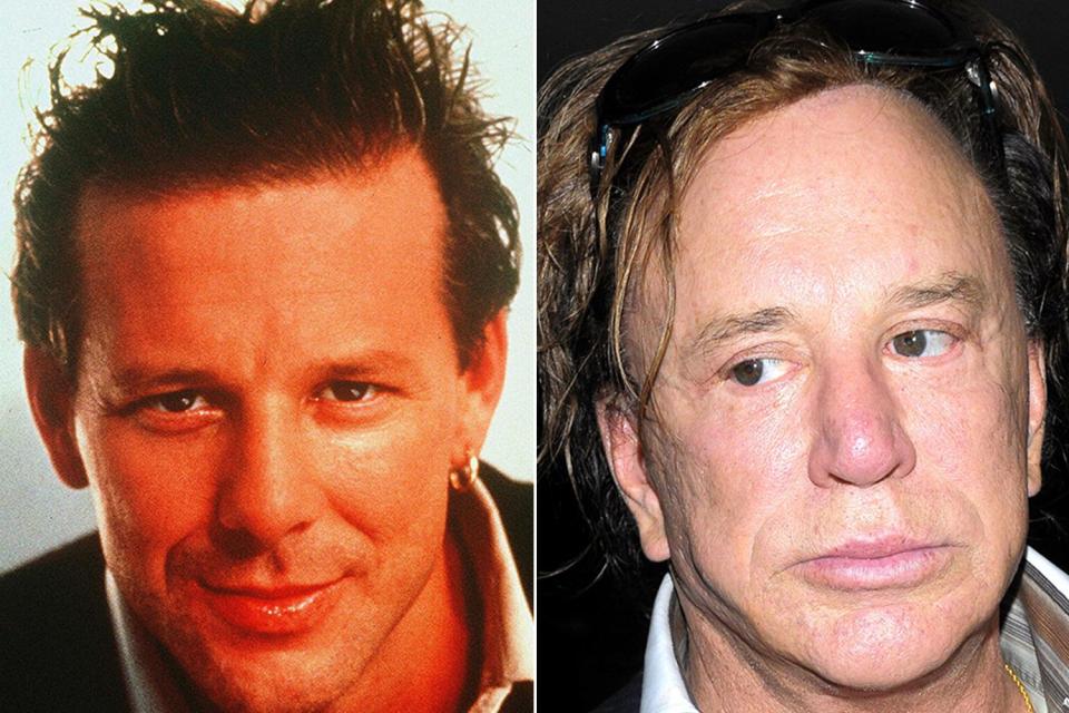  Mickey Rourke is almost unrecognisable today