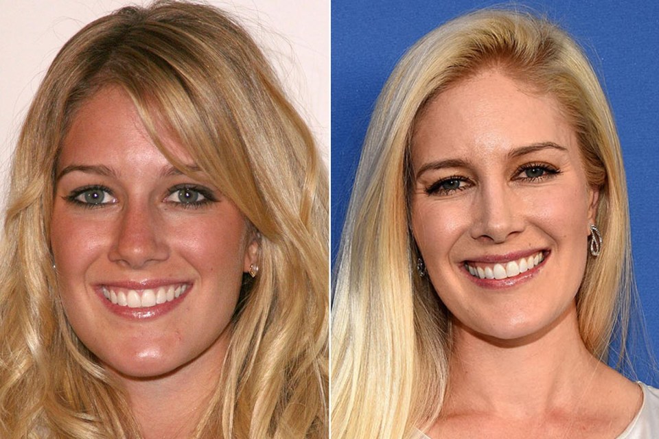 Heidi Montag also looks very similar to her younger self