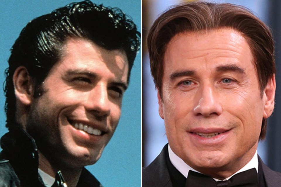 John Travolta has tried to hold onto his youthful looks