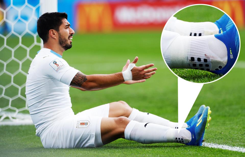  Barcelona's Luis Suarez is the only player paid to wear the socks