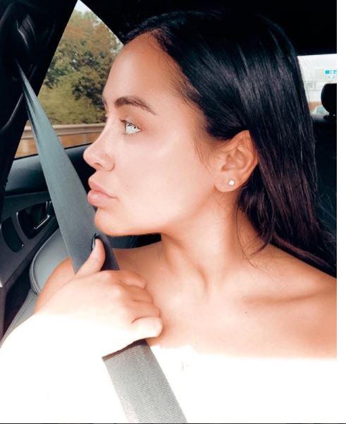  Marnie claims shes stopped having lip fillers after they ruined her natural lip line