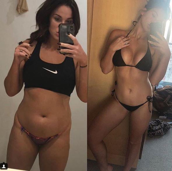  Vicky Pattison posted this before and after picture on Instagram