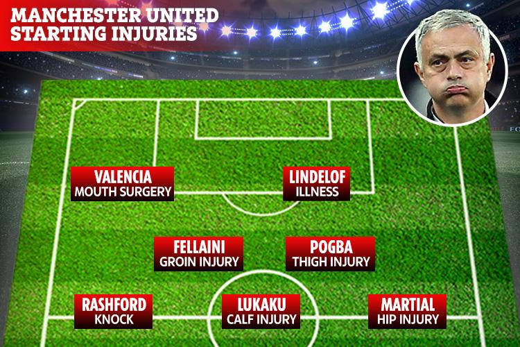  Manchester United's injuries are mounting ahead of their game this weekend