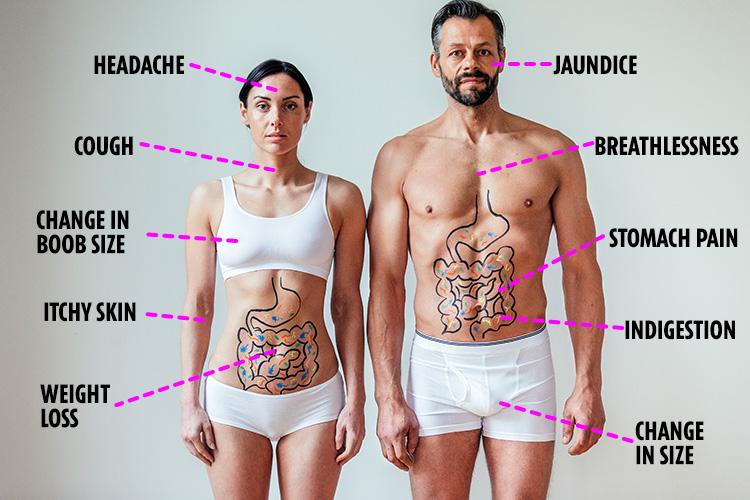  Lung cancer is the most deadly cancer, followed by bowel and prostate