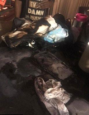 Timiyah's clothes and room were also badly burnt