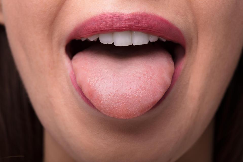  Our tongues house more than 200 different types of bacteria