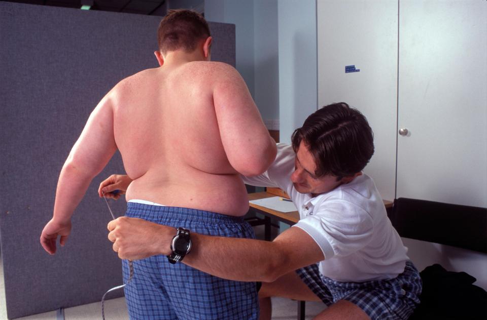  People who were obese as kids had the highest BMIs of all