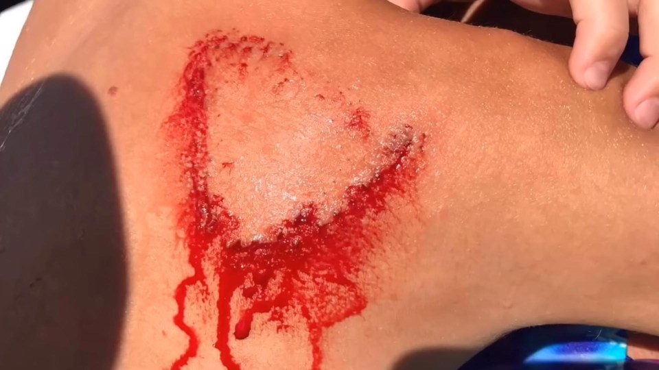 An eight-year-old boy was bitten by a shark during a holiday in the Bahamas