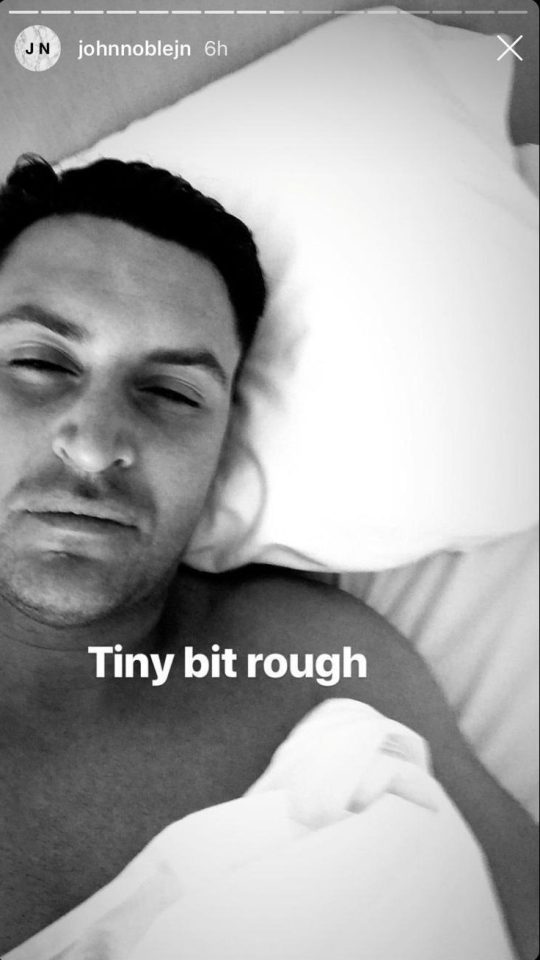  John posted a selfie on his Instagram story following his night out, telling his fans he felt a 'tiny bit rough'