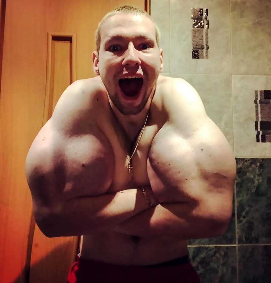  The controversial bodybuilder has been criticised by health experts for injecting synthol into himself